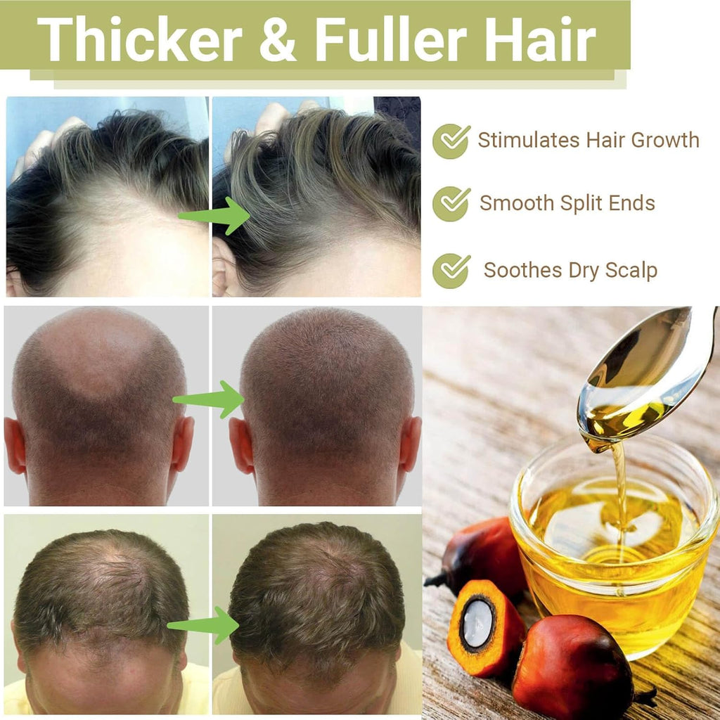 RAW Batana Oil for Hair Growth, Dr Sebi Organic Unrefined Batana Oil from Honduran, 100% Pure & Natural Hair Growth for Thicker & Stronger Hair - 2 FL OZ - 60Ml - 1Pack - natuurlijk supplement | naturalcleance.com